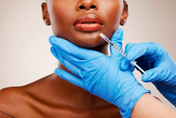 Lip Body Filler
