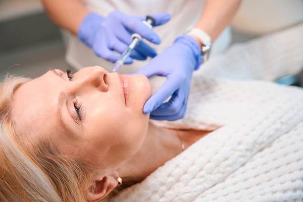 Nasolabial Fold Filler
